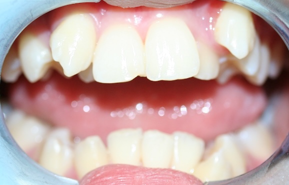 Linda before