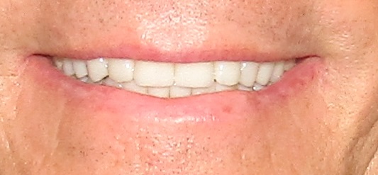 Ryan after