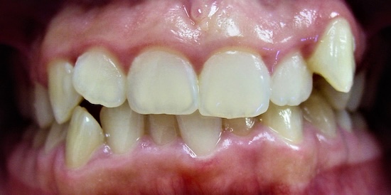 Julie Before