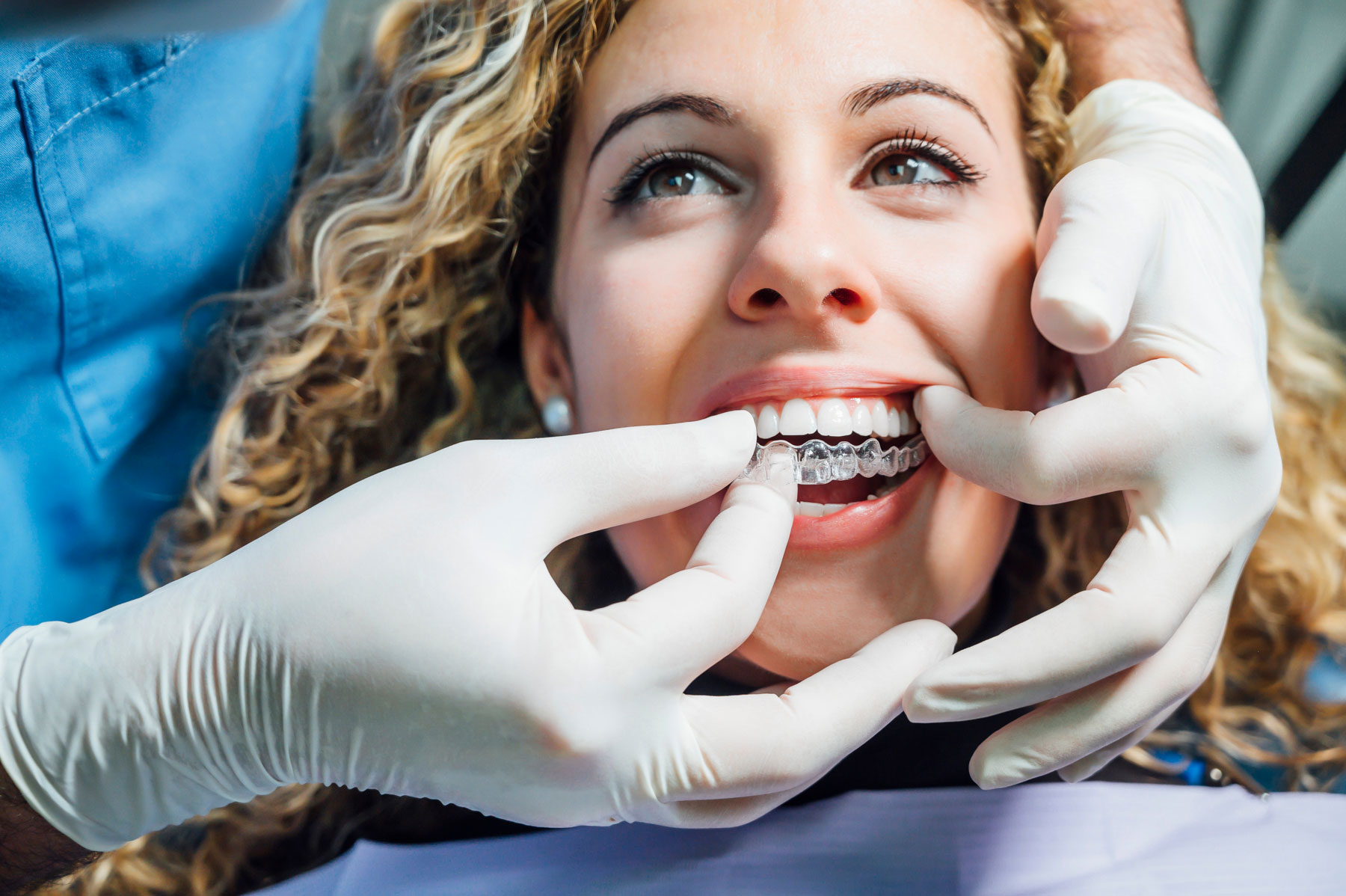 Invisalign Invisalign